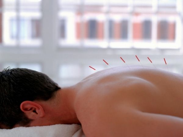 Dry Needling Therapy Columbia MD